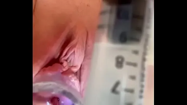 HD as cervix painfully dilated w catheter memandu Filem